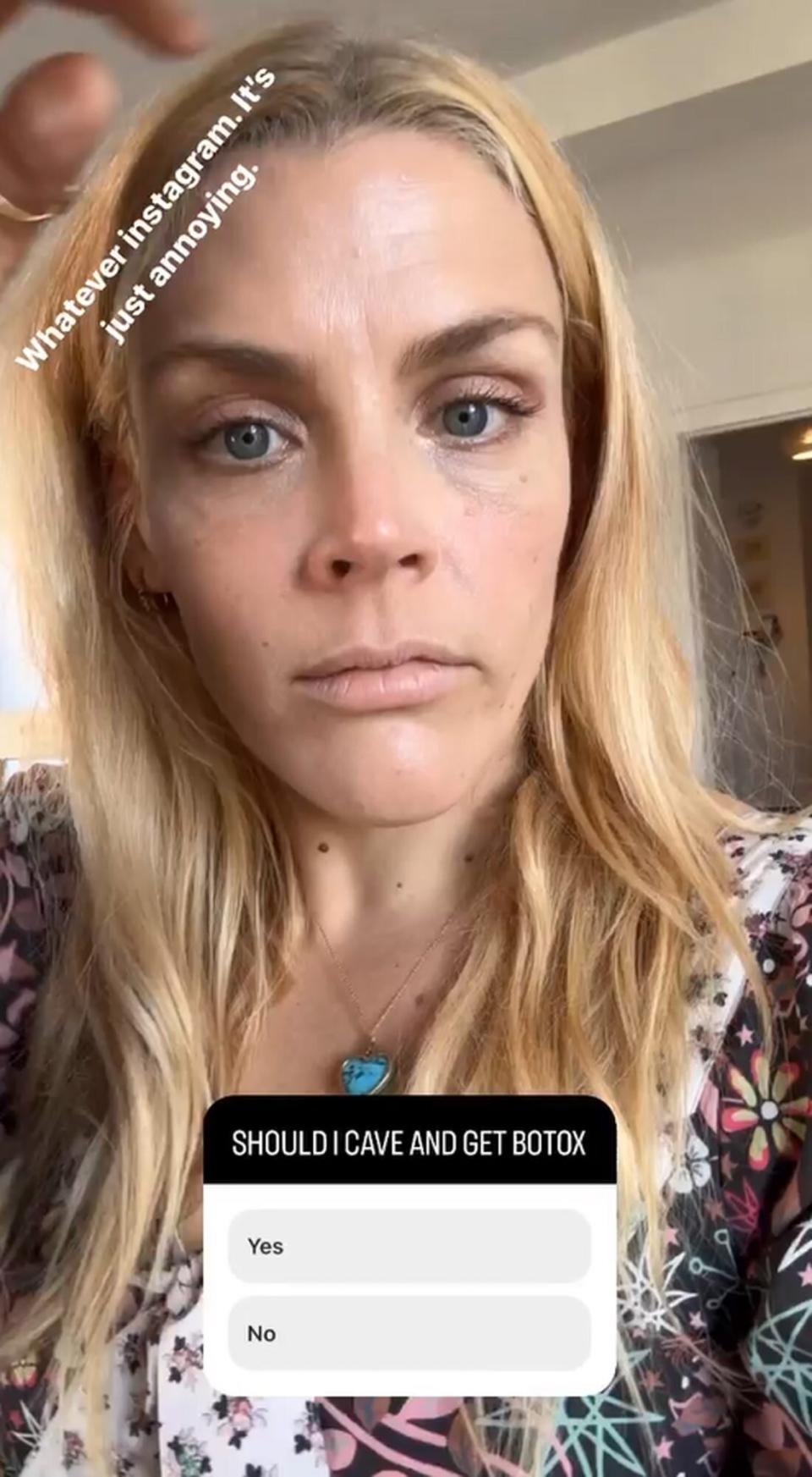 Busy Philipps Botox?