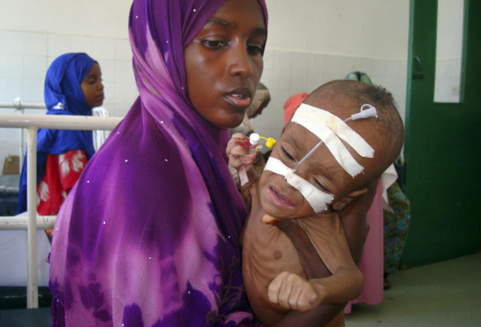Amina Mohammed holds her malnourished daughter Ruqiyo, 6 months old, at the Banadir hospital where she is receiving treatment in Mogadishu, Somalia Tuesday, May 15, 2012. Sub-Saharan African nations will not be able to sustain their accelerated economic growth, now around 4 percent and accelerating faster than the rest of the world excluding China and India according to UNDP statistics, unless they eliminate hunger, the U.N. said in a report Tuesday. (AP Photo/Mohamed Sheikh Nor)