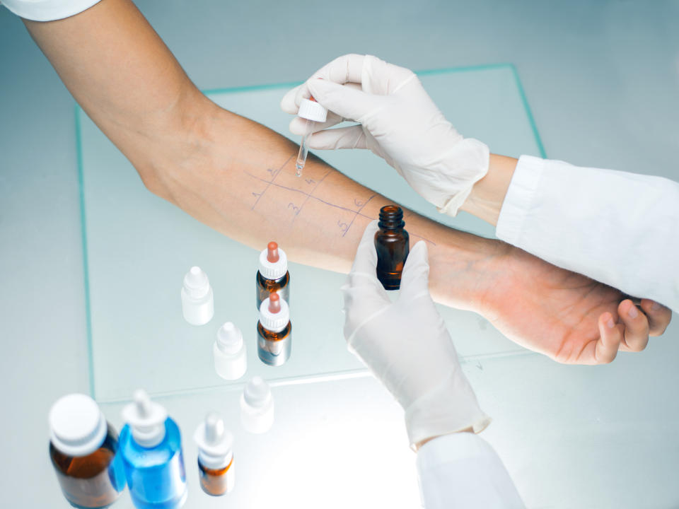 Dr. Tania Elliott says a skin allergy test is “the most sensitive test” and can identify the things you are most allergic to. (Getty Images)