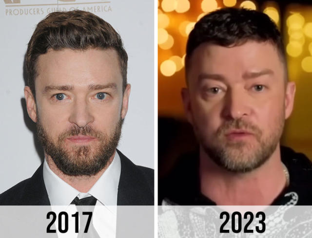 Fans Think Justin Timberlake Had 'Bad Plastic Surgery' After His