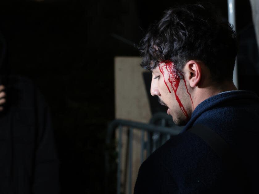 A Pro-Palestinian protester bleeds from his head after clashing with pro-Israeli