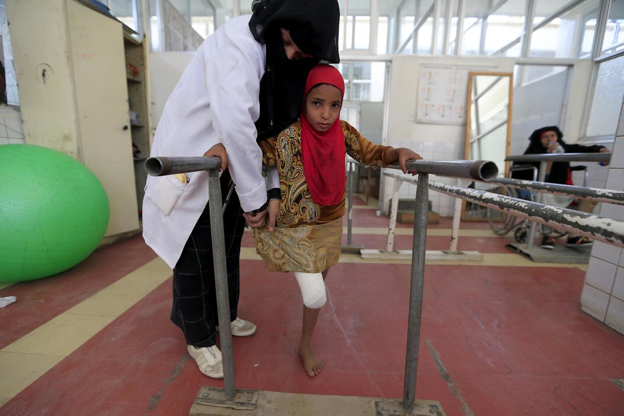 A wounded Yemeni girl exercises at a clinic for prosthetic limbs and physical rehabilitation in the capital Sanaa: Photo by MOHAMMED HUWAIS/AFP via Getty Images