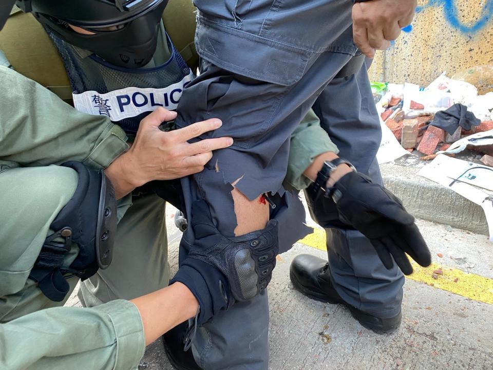 In this photo released by the Hong Kong Police Department, police prepare to remove an arrow from the leg of a fellow officer during a confrontation with protestors at the Hong Kong Polytechnic University in Hong Kong, Sunday, Nov. 17, 2019. (Hong Kong Police Dept. via AP)