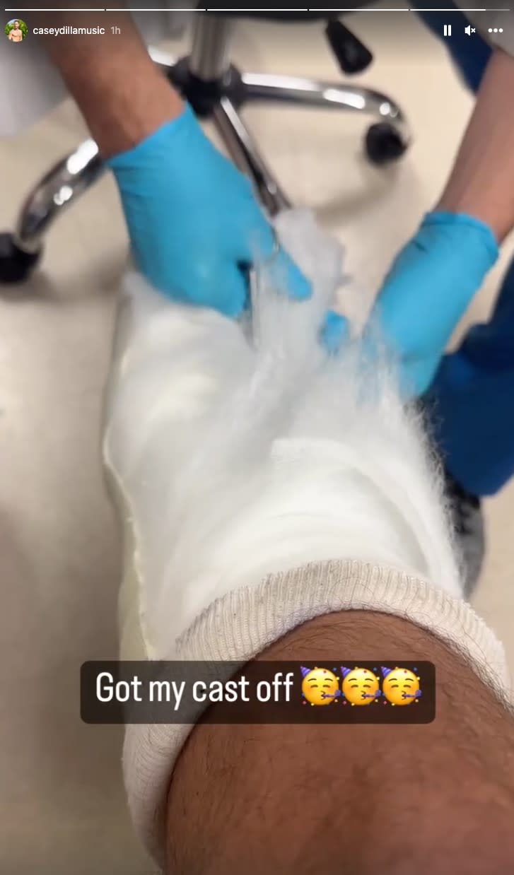 Casey Woods, Cast Removal