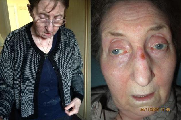 Pat is seen in dirty clothes on the left and on the right, in another photograph with unexplained facial injuries
