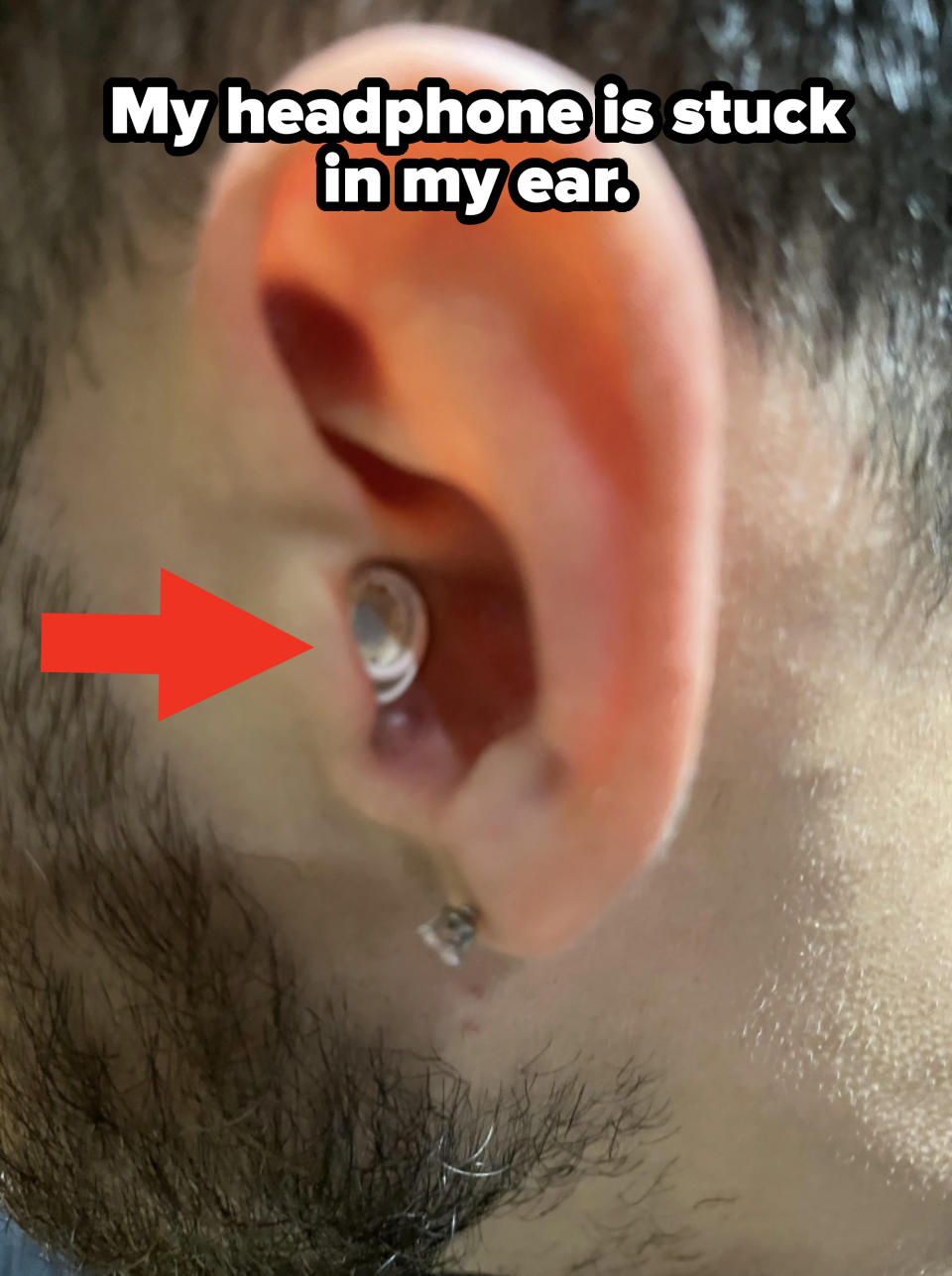 Close-up of a person's ear with an earbud deep inside, with caption "My headphone is stuck in my ear"