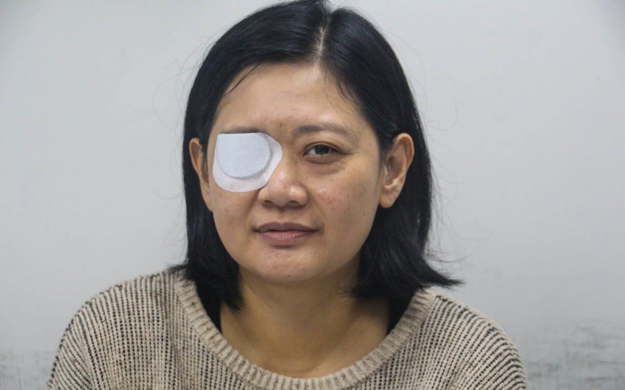 Veby Mega Indah, who was blinded in one eye during protests, sues Hong Kong police