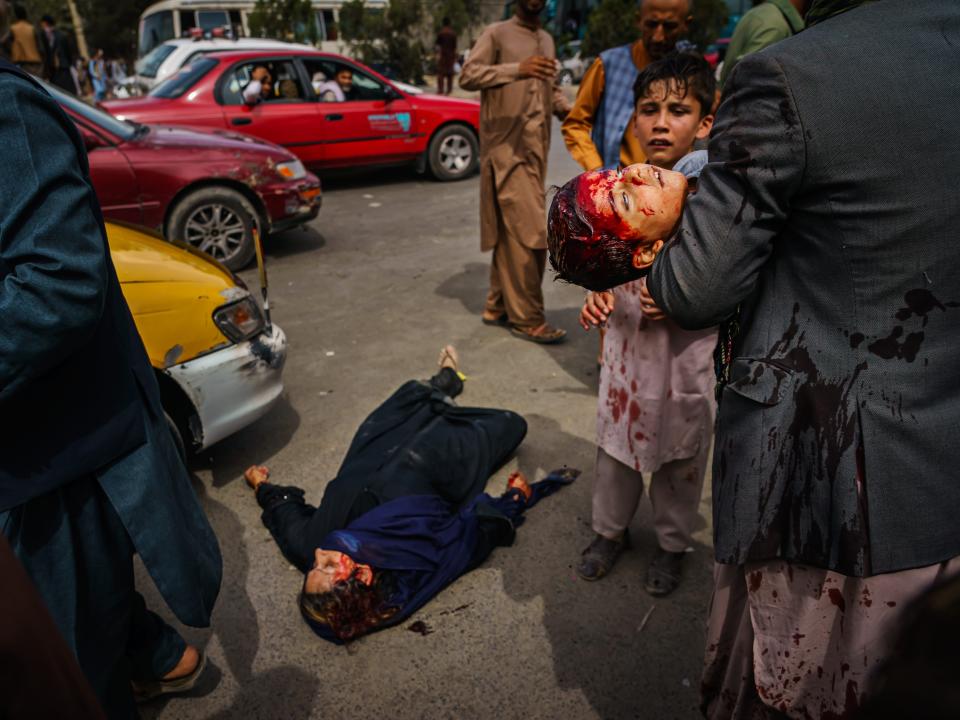 A man carries a bloodied child, as a woman lays wounded on the street at the Kabul Airport