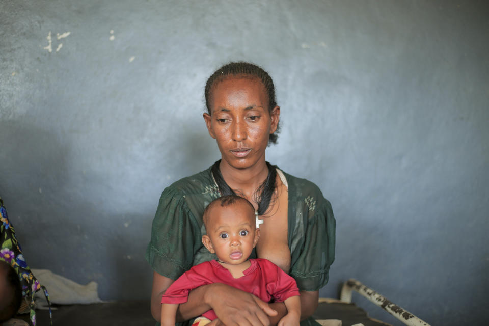 Lete Yohannes, 34, holds her baby Temesgen Muluhaw, 8 months-old, who is suffering from malnutrition, at the Finarwa Health Center in Mai Mekden, in the Tigray region of northern Ethiopia, on Tuesday, Feb. 27, 2024. (AP Photo/Amir Aman Kiyaro)