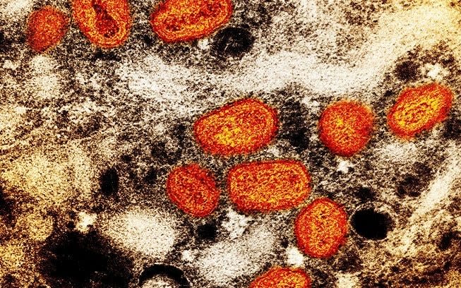 A colorized transmission electron micrograph of mpox particles (orange) found within an infected cell (brown), cultured in the laboratory