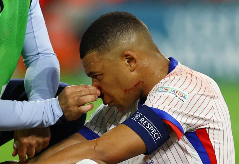Mbappe suffered a burst nose and was forced off in France’s 1-0 win (REUTERS)