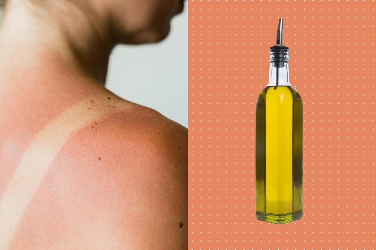 Diptych of a woman with a sunburn and bottle of olive oil