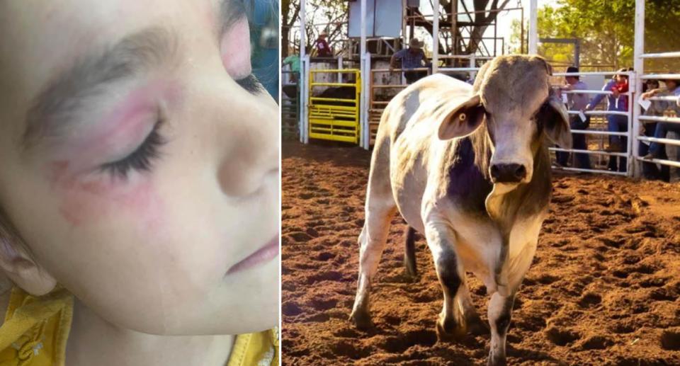 Girl with facial injuries after bull escapes enclose at rodeo. 