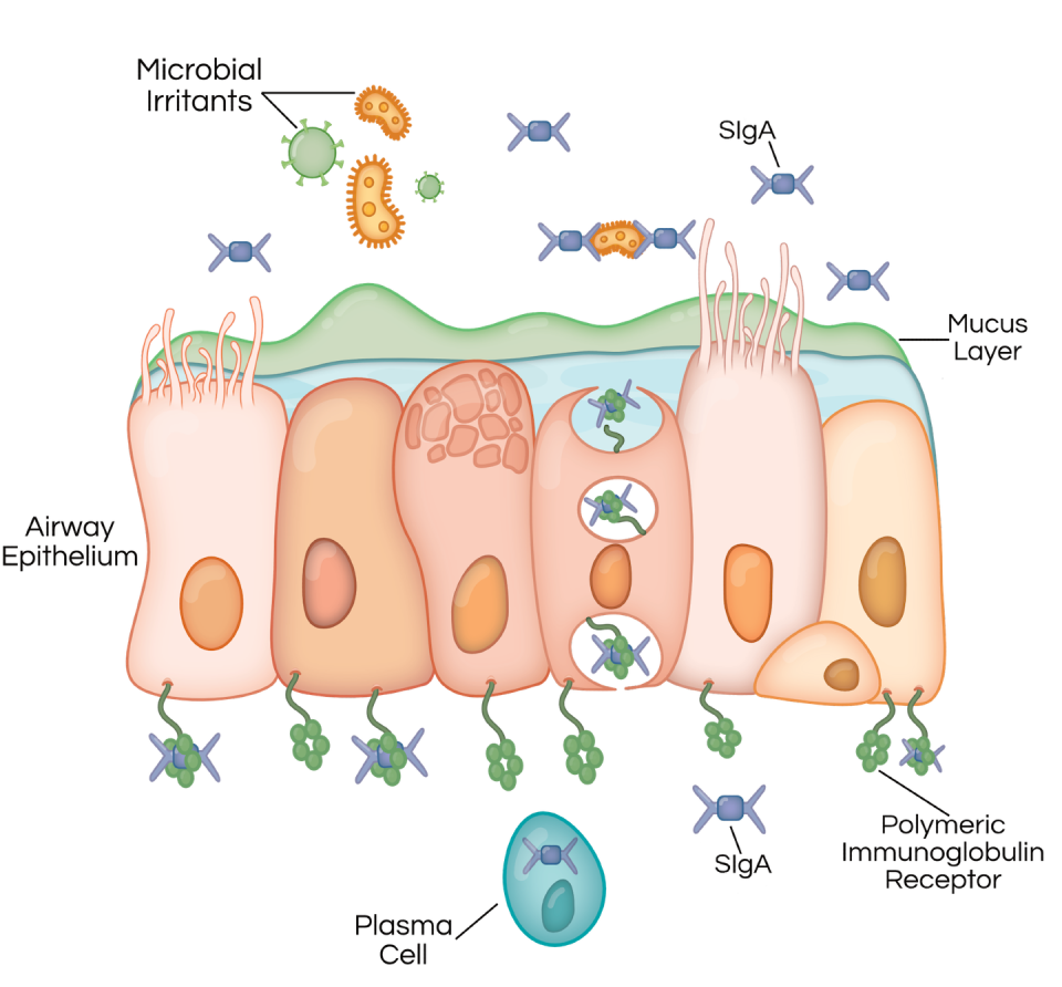 Our airways are lined with a layer of cells called the airway epithelium. When bacteria and other germs are inhaled, one way the airway epithelium protects itself is by transporting secretory immunoglobulin A (SIgA) to the airway surface. SIgA attaches to bacteria to prevent them from invading and causing inflammation. SIgA is made by plasma cells beneath the airway epithelium and transported by polymeric immunoglobulin receptors. People with COPD lack SIgA in their airways, which allows bacterial invasion, inflammation and lung damage. Dayana Espinoza/Vanderbilt University, <a href="http://creativecommons.org/licenses/by-nd/4.0/" rel="nofollow noopener" target="_blank" data-ylk="slk:CC BY-ND;elm:context_link;itc:0;sec:content-canvas" class="link ">CC BY-ND</a>