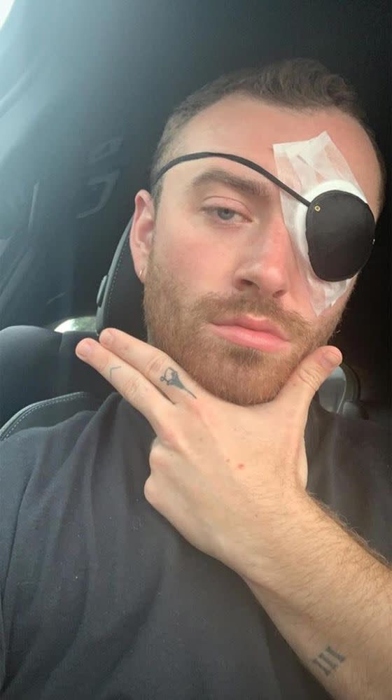 Sam Smith Has Eye Surgery After Suffering from a Stye