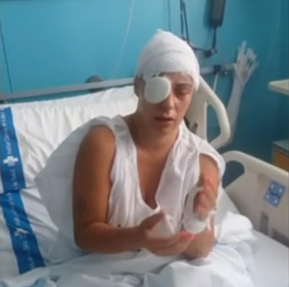 Ana Mari, in seen in the hospital after the alleged attack. Source: Australscope