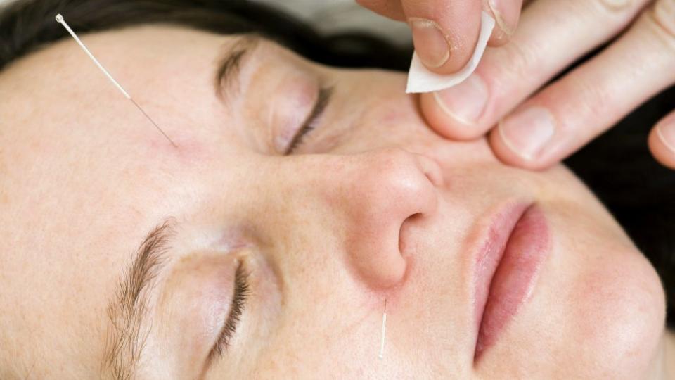 The holistic treatment looks at everything from hormonal imbalances, to the digestive system, blood flow and stress. Photo: Getty