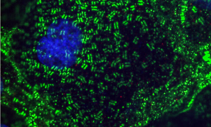 In lab experiments, infection of heart muscle cells with SARS-CoV-2 caused long fibers to break apart into small pieces, shown above. (Gladstone)