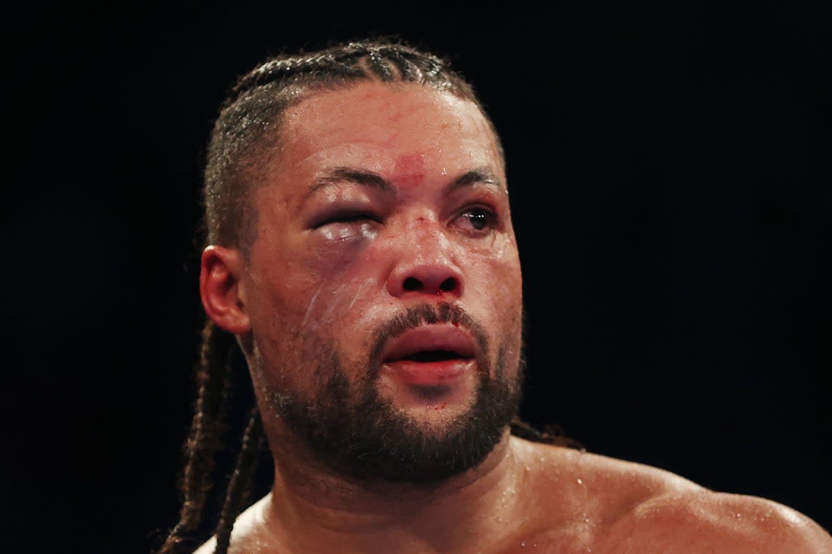 Damage: Joe Joyce saw his right eye closed during a punishing defeat by Zhilei Zhang  (Getty Images)