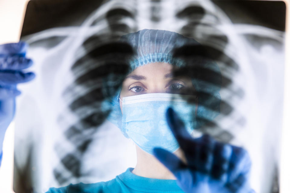 Healthcare worker holding up an X-ray film