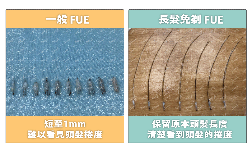 圖三：一般FUE與長髮免剃FUE毛囊比較