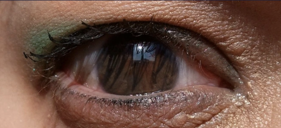 Close-up of a person's eye with no pupil, just iris