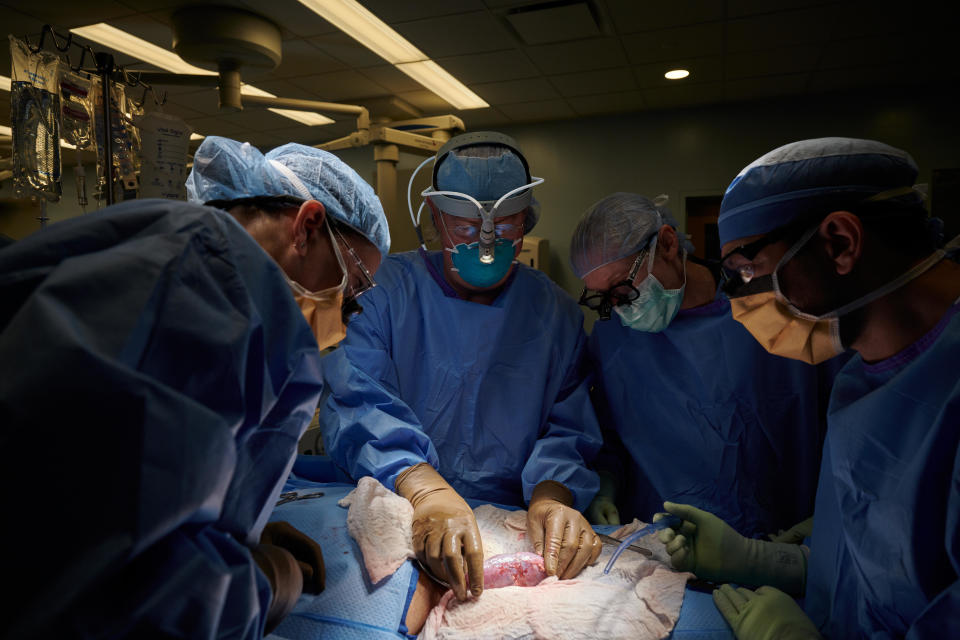 Surgeons conduct a xenotransplant with a genetically engineered pig kidney on September 25.  / Credit: NYU Langone