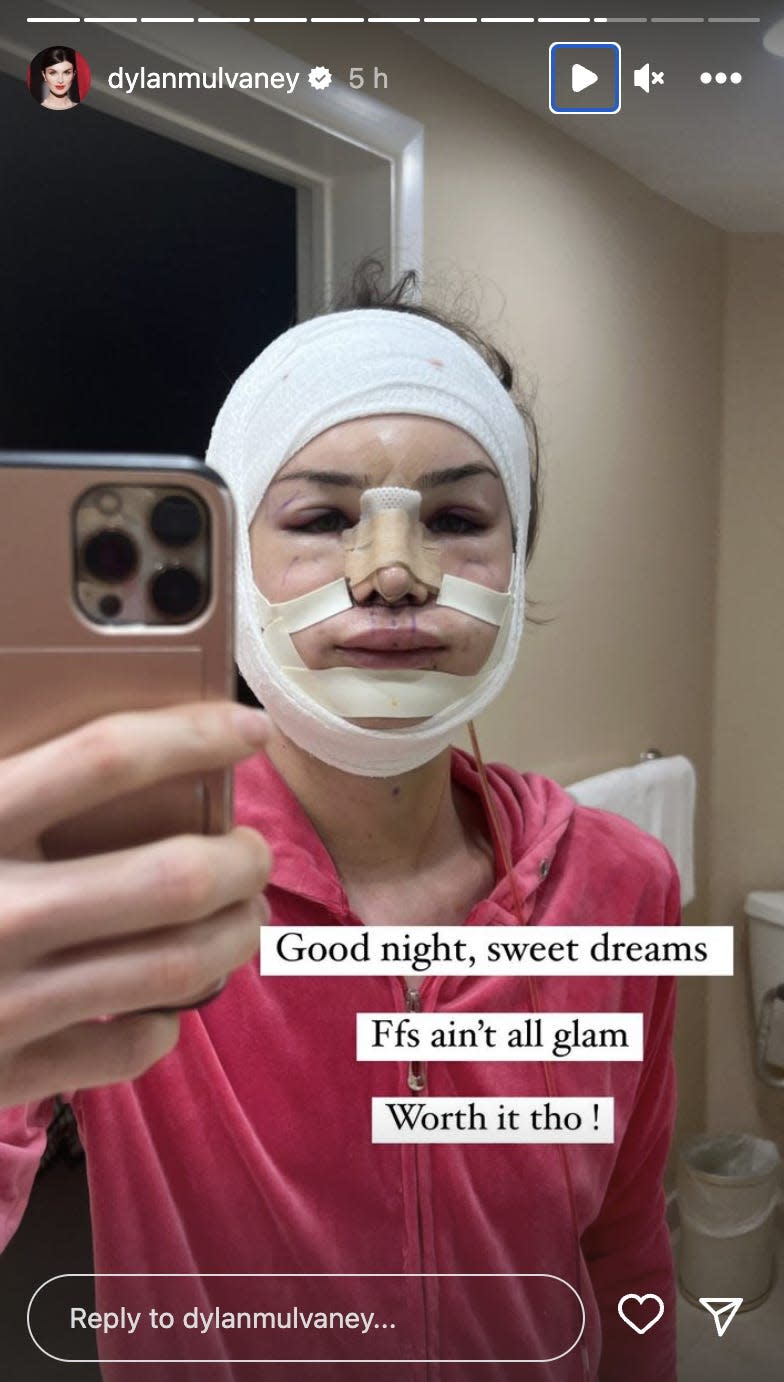 Dylan Mulvaney also shared a less "glam" glimpse into her recovery from facial feminization surgery.