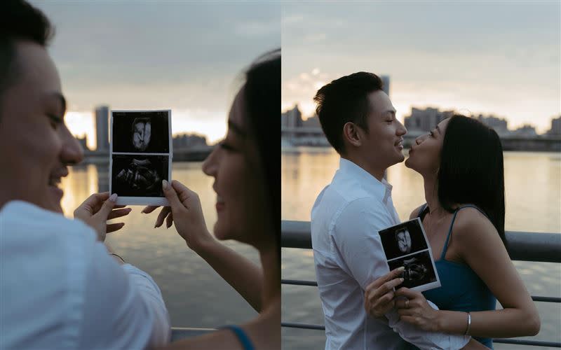 卡卡曬出超音波照，宣布懷孕。（圖／翻攝自 卡卡 IG）