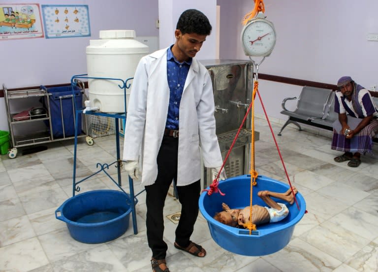 A Yemeni child suffering from malnutrition is weighed at a hospital in the northern district of Abs in the northwestern Hajjah province on September 19, 2018