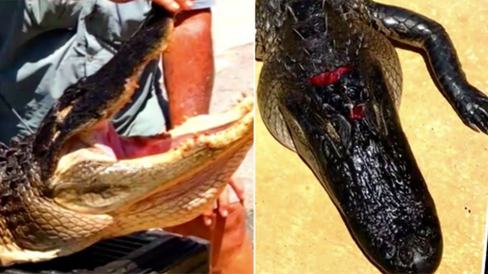 It's claimed the girl managed to open the gator's mouth after it clamped dow on her. Photos: ABC News US