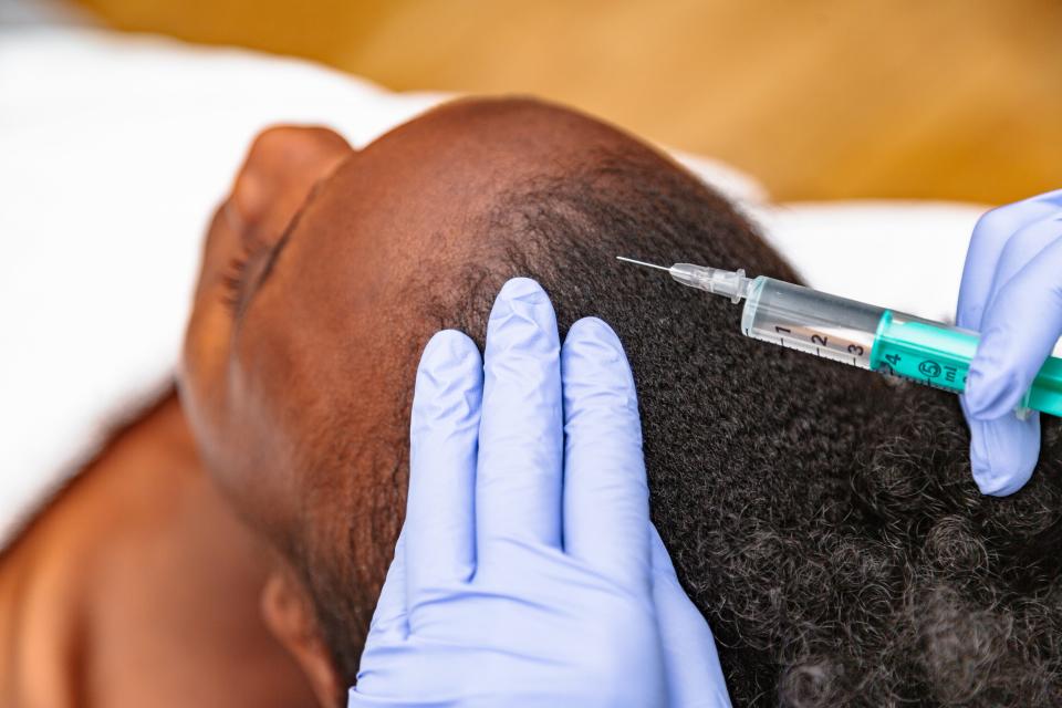 Woman receives Botox Injection along her scalp.