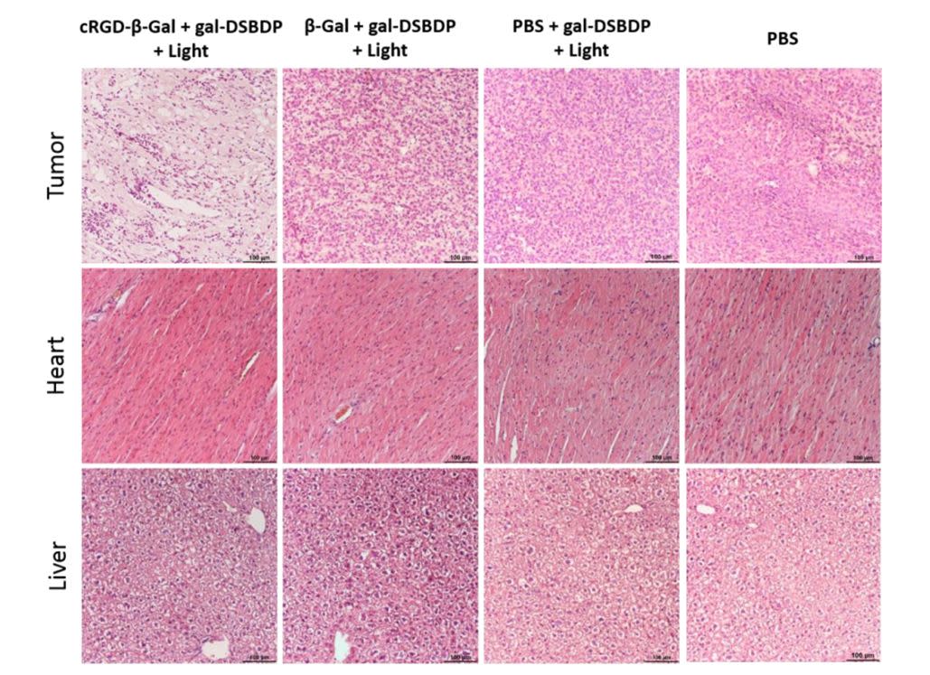 Fotoinmunoterapia logra destruir celulas cancerosas en un tumor cerebral | imagen Xiong, Junlong, et al. 