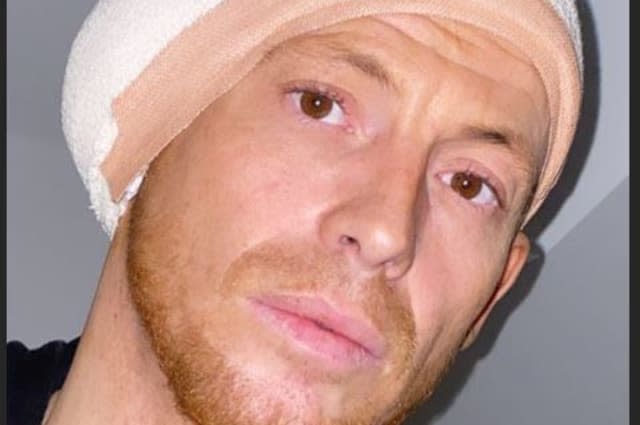 Joe Swash opens up about horror ear injury during Dancing On Ice training