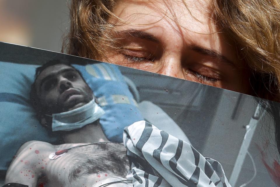 A woman cries holding a poster showing a photo of a protester beaten by police in a hospital, during a rally in Minsk, Belarus, Saturday, Aug. 15, 2020. Thousands of demonstrators have gathered at the spot in Belarus' capital where a protester died in clashes with police, calling for authoritarian President Alexander Lukashenko to resign. (AP Photo/Dmitri Lovetsky)