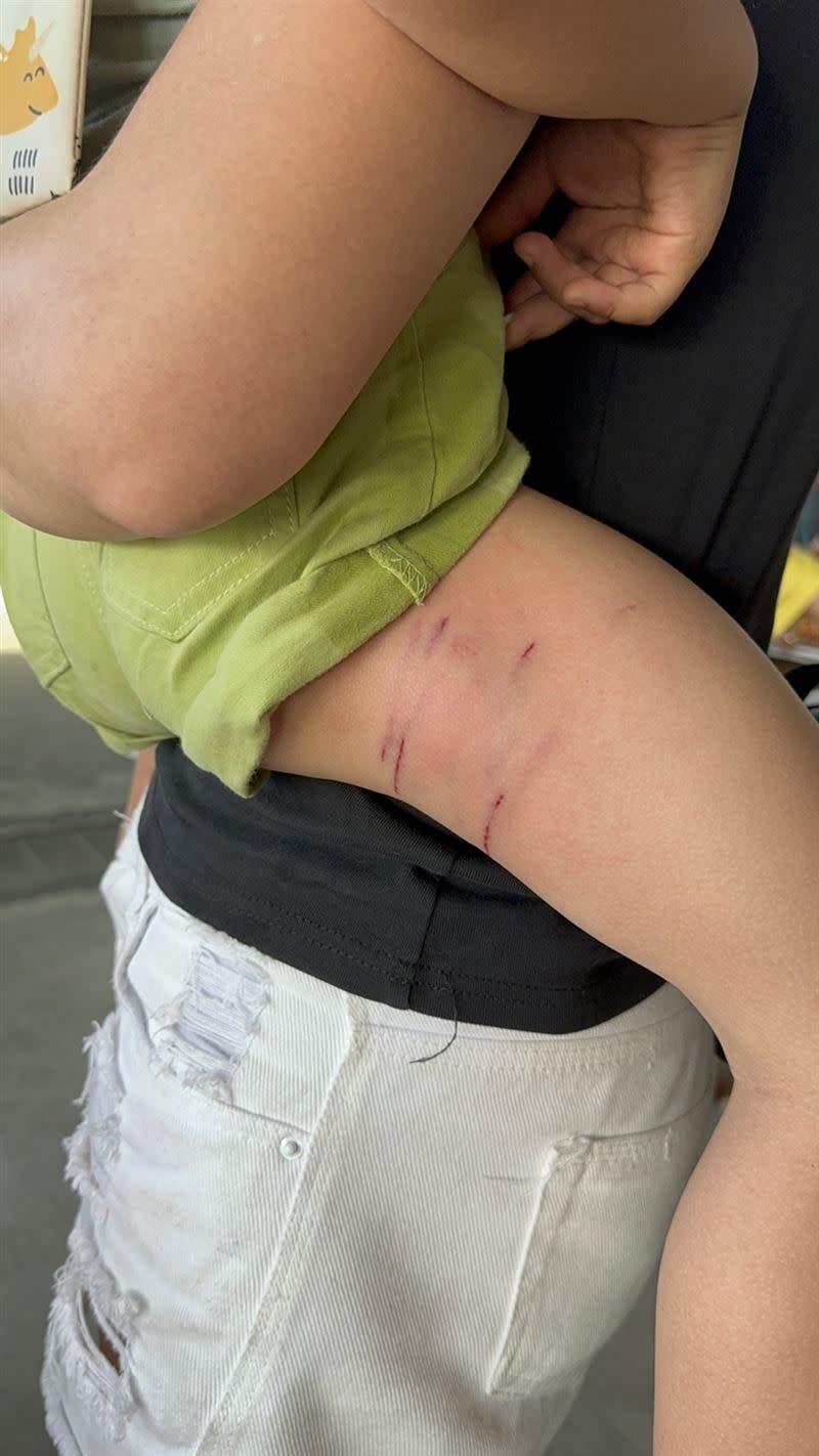 男童大腿遭鄰桌客人的犬隻咬傷。（圖／翻攝畫面）