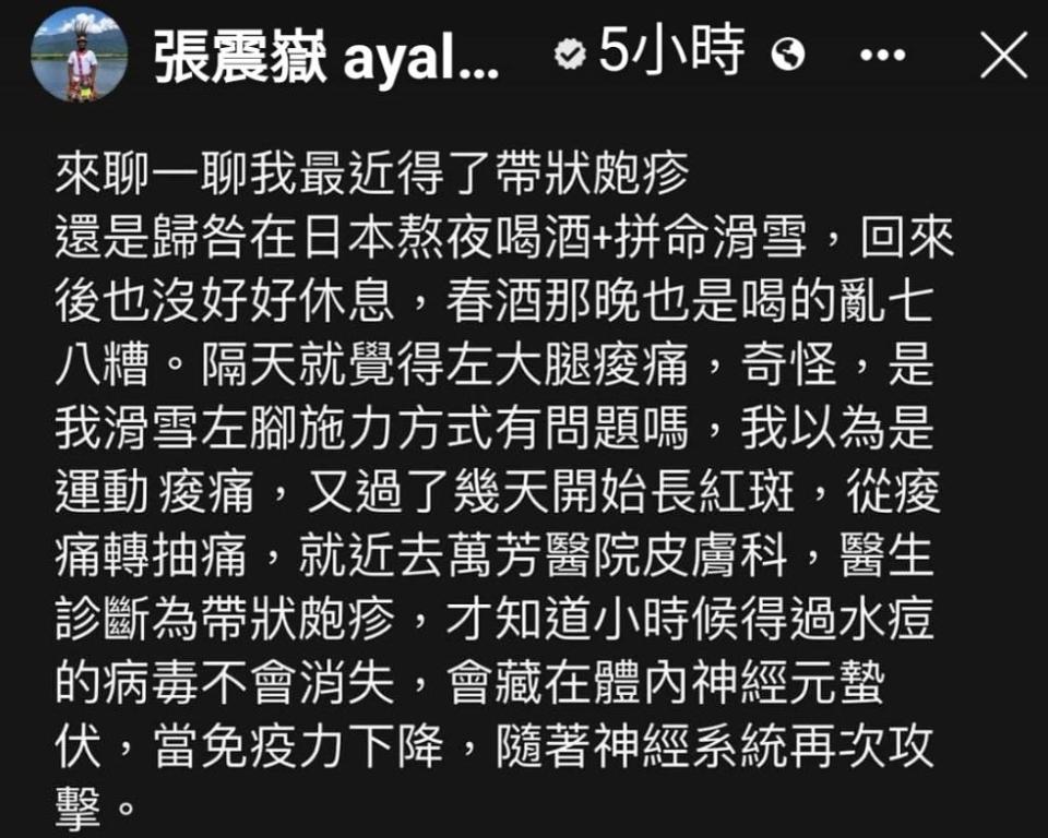 張震嶽染帶狀皰疹 痛到走路一拐一拐"如長芒果"