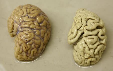 One hemisphere of a healthy brain (L) is pictured next to one hemisphere of a brain of a person suffering from Alzheimer disease, at the Morphological unit of psychopathology in the Neuropsychiatry division of the Belle Idee University Hospital in Chene-Bourg near Geneva March 14, 2011. REUTERS/Denis Balibouse