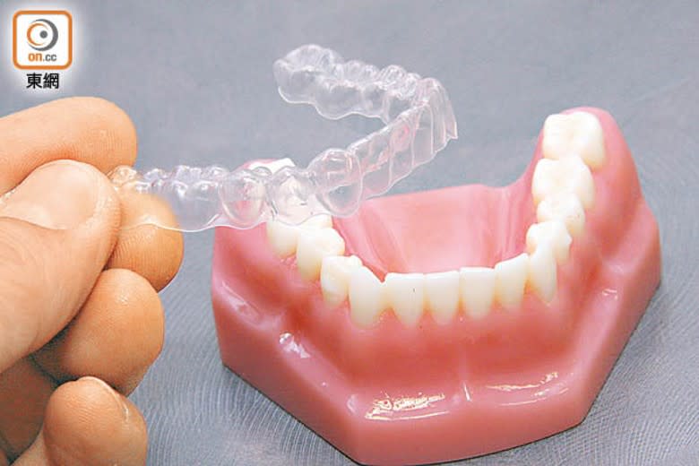 隱形牙套為近年興起的箍牙技術，市民選擇服務時需留意風險。