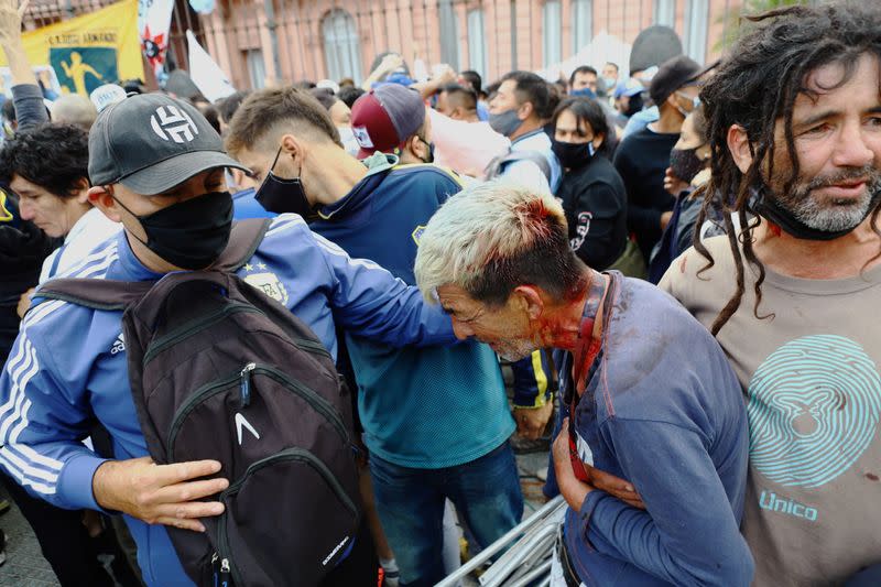 MATERIAL SENSIBLE. ESTA IMAGEN PUEDE OFENDER O MOLESTAR. Un hombre herido tras choques con la policía en medio de la despedida del fallecido astro del fútbol Diego Armando Maradona en el palacio presidencial Casa Rosada, en Buenos Aires, Argentina