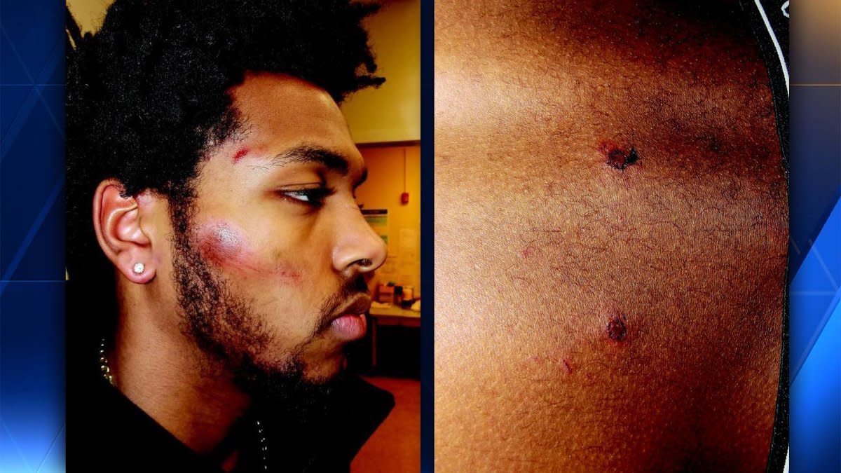 Bucks rookie Sterling Brown suffered face and back injuries after being tackled and Tased by Milwaukee police. (WISN-TV)