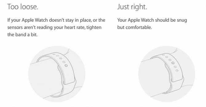 Apple Watch引發過敏症狀？！