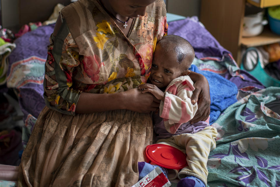 Tekien Tadese, 25, holds her baby, Amanuel Mulu, 22 months old, who is suffering from malnutrition and weighs only 6.7 kilograms (14 pounds and 12 ounces), at the Ayder Referral Hospital in Mekele, in the Tigray region of northern Ethiopia, on Monday, May 10, 2021. The child was unconscious when he was first admitted in April, severely malnourished and anemic after losing half his body weight. Two weeks in intensive care saved his life. (AP Photo/Ben Curtis)