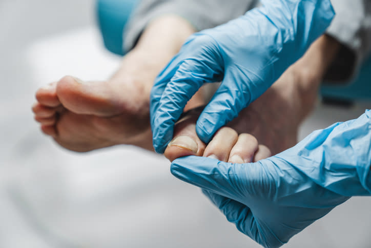 A close-up of someone wearing blue medical gloves examining another person's foot and toenails