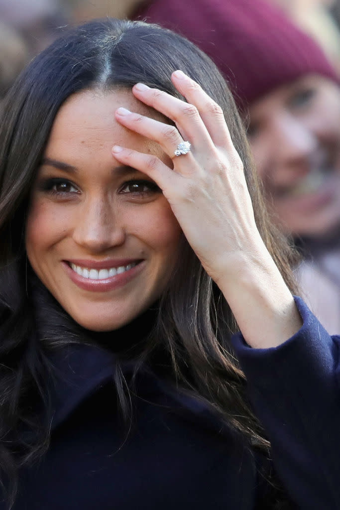 “Meghan has an almost perfectly shaped nose with a 98.5 percent score.” (Photo: Getty)