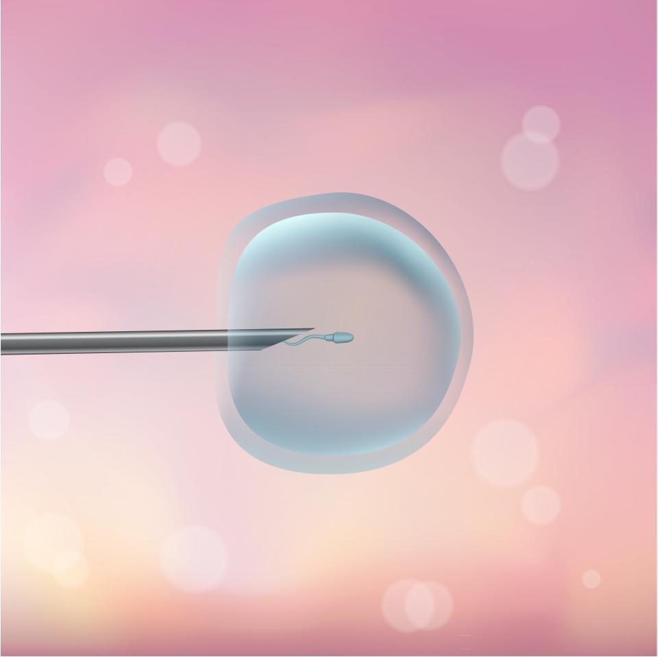 A drawn image of the IVF process internally