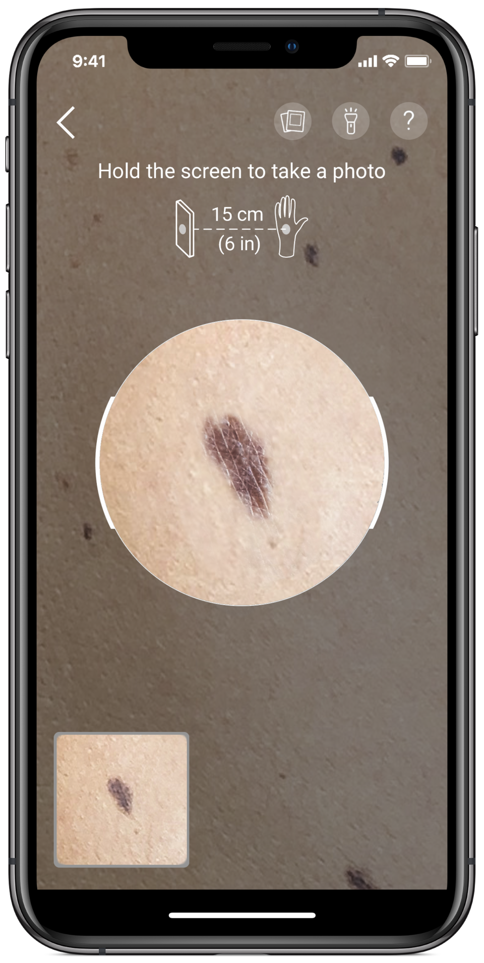 Use your phone to take a close-up of skin blemishes.