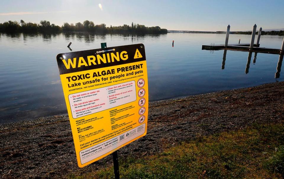 The Benton Franklin Health District has posted numerous signs warning that people and their pets should stay out of the Columbia River at Richland and Pasco. Bob Brawdy/bbrawdy@tricityherald.com