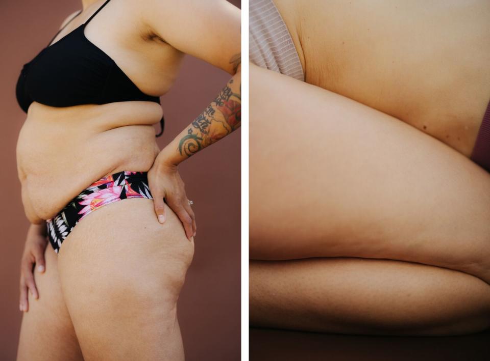 A photo diptych shows the profile of a woman's torso and upper legs, and a woman's thigh