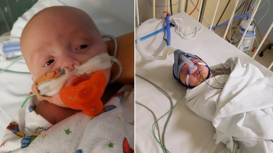 Three-month-old Harrison had to airlifted to The Sydney Children's Hospital at Randwick. Photo: Facebook